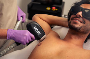 Laserontharen voor mannen